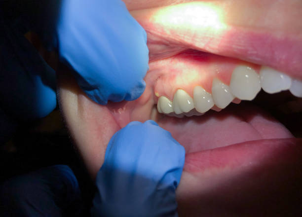 Best Emergency TMJ Treatment in Winnsboro, SC